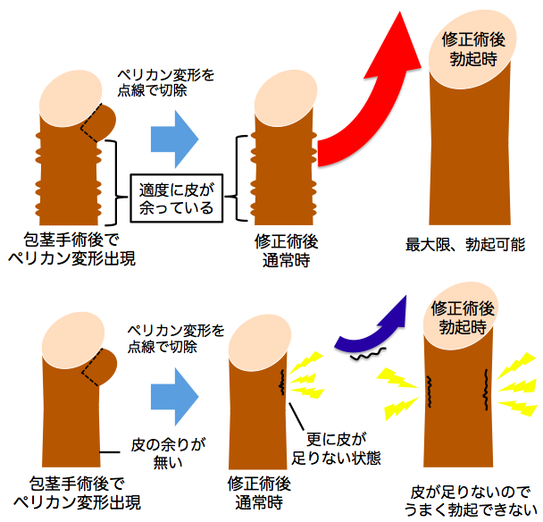 露茎を考察する ～大きさもね編～ |