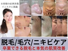 尾張旭市で美肌が人気のエステサロン｜ホットペッパービューティー