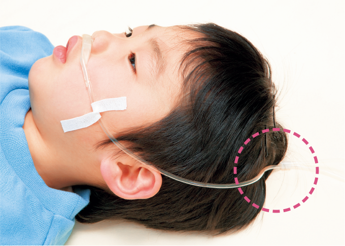 在宅酸素療法 HOT