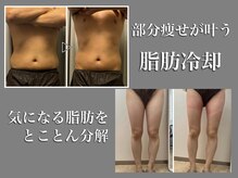 とろリッチのメンズエステ求人情報 - エステラブワーク名古屋（愛知）