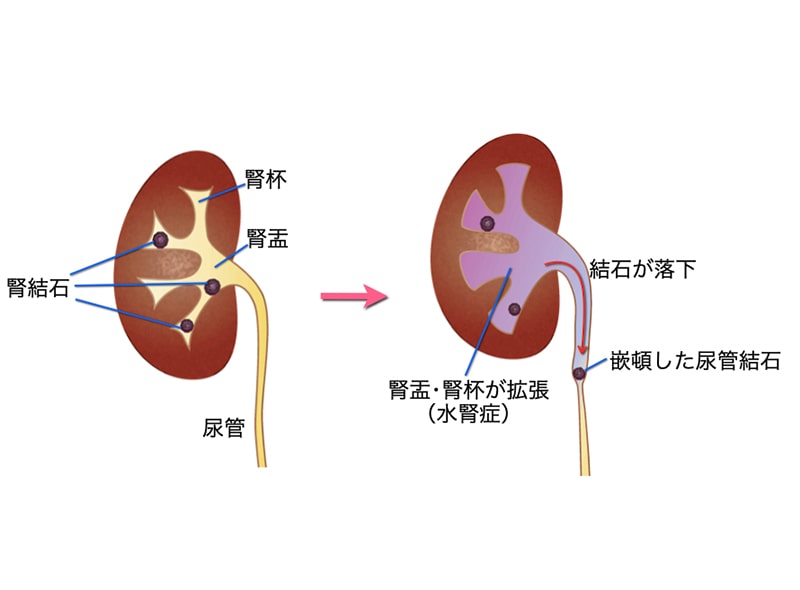 病気の話 | 救急病院・労災指定