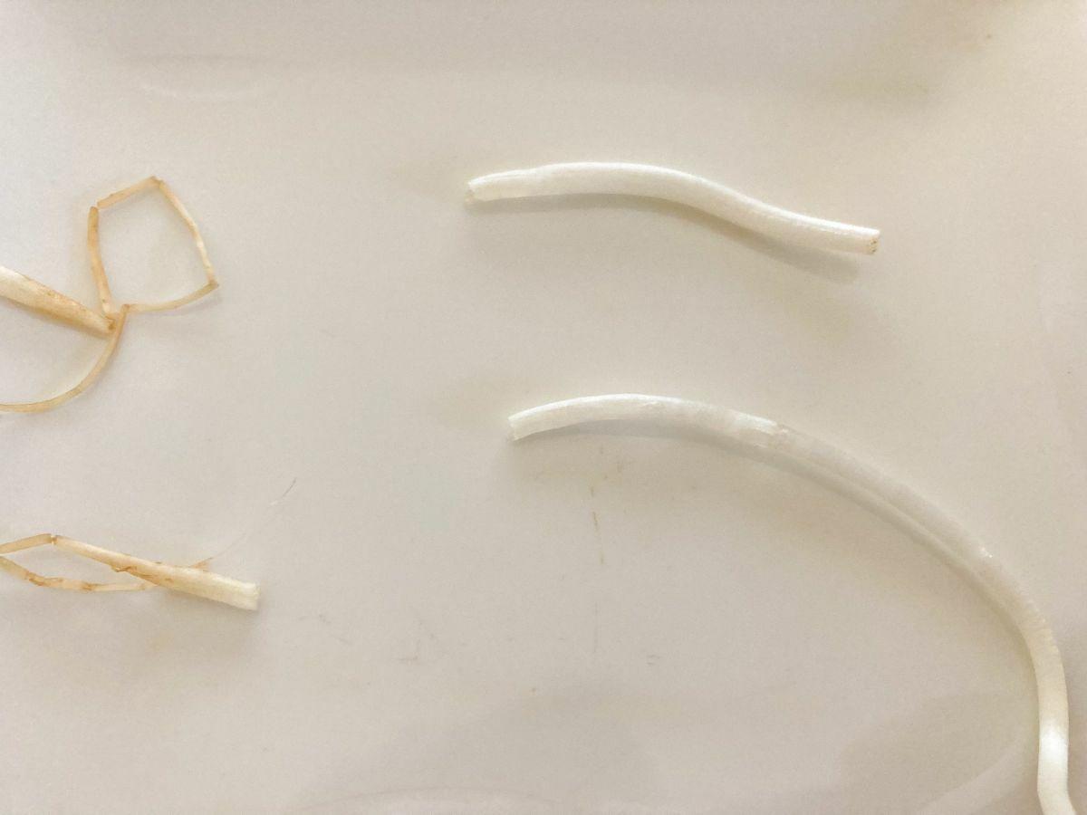 もやし」←「ひげ根は取るの？」or「取らないの？」元スーパーの店員の回答に 。「早く教えてよ」 ぱるとよ- エキスパート - Yahoo!ニュース