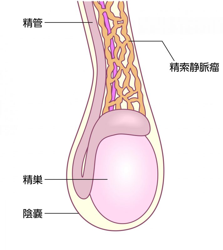 精子の質」の保証が甘い、現状の不妊治療 – MONEY