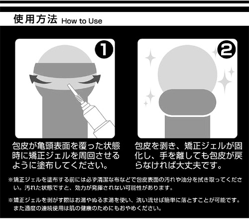 ヒルズタワークリニックで包茎を治す