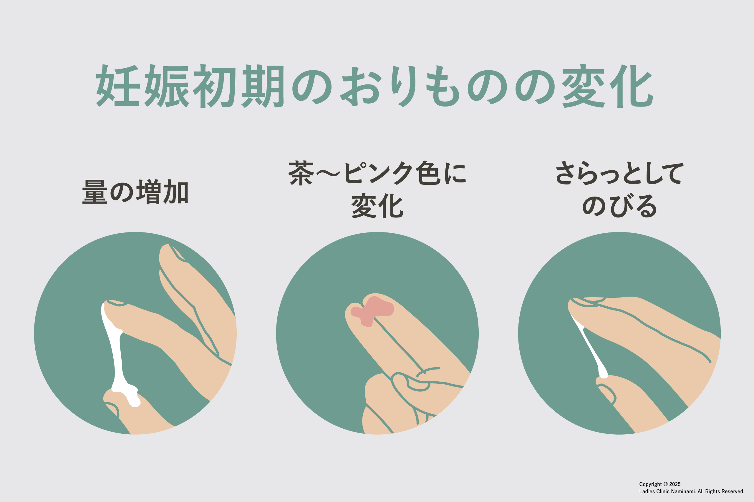 おりものが黄色いときに考えられる原因はこれ！症状別にやさしく解説