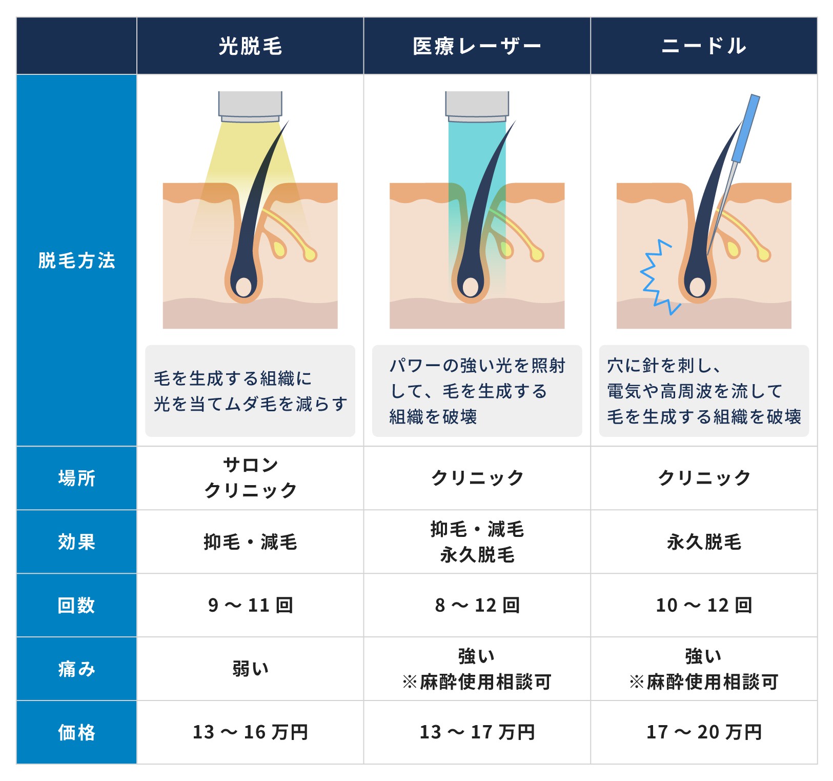 自由が丘でメンズ脱毛・ヒゲ脱毛がおすすめの人気の医療クリニック＆サロン9選