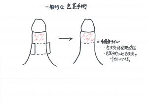 横浜の包茎手術おすすめクリニック30院比較│費用・手術方法・実績 - アトムクリニック -