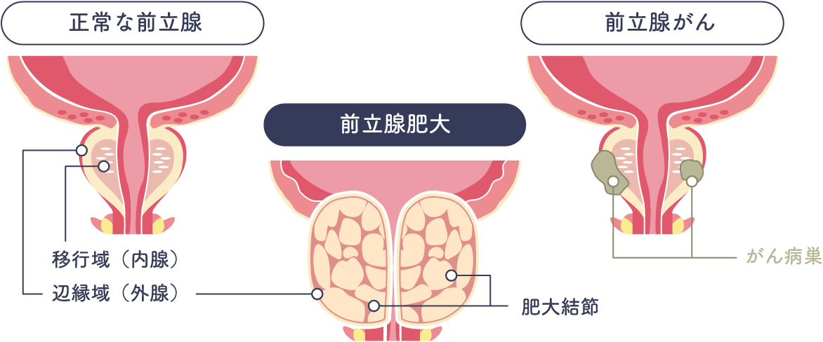 ナイトウ薬品/旧:ナイトウ薬局/豊田市/喜多町】前立腺/マサージ器/前立腺液搾り出し/リフレッシュ/用具/前立腺 肥大防止/豊田市駅東口徒歩7分以内tel:0565(33)8037◇ひまわり通り/三重銀行角北10ｍ