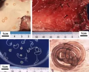 福岡市 アニサキス食中毒を予防しましょう