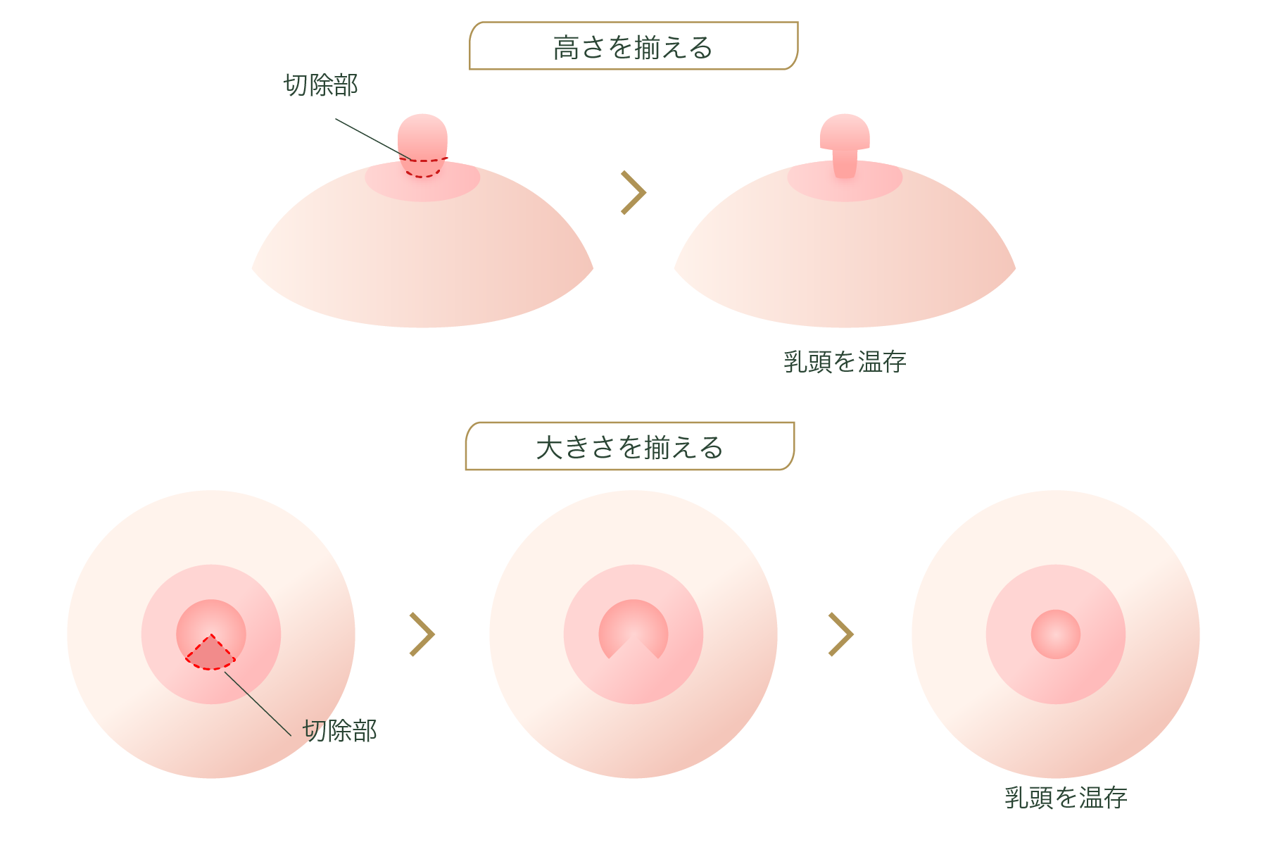 ピンクの乳首の色に近づける黒ずみ対策【医師監修】 - 夜の保健室