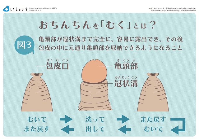 クリトリスの皮を剥くコツは？クリイキするための正しい剥き方をイラストでチェック