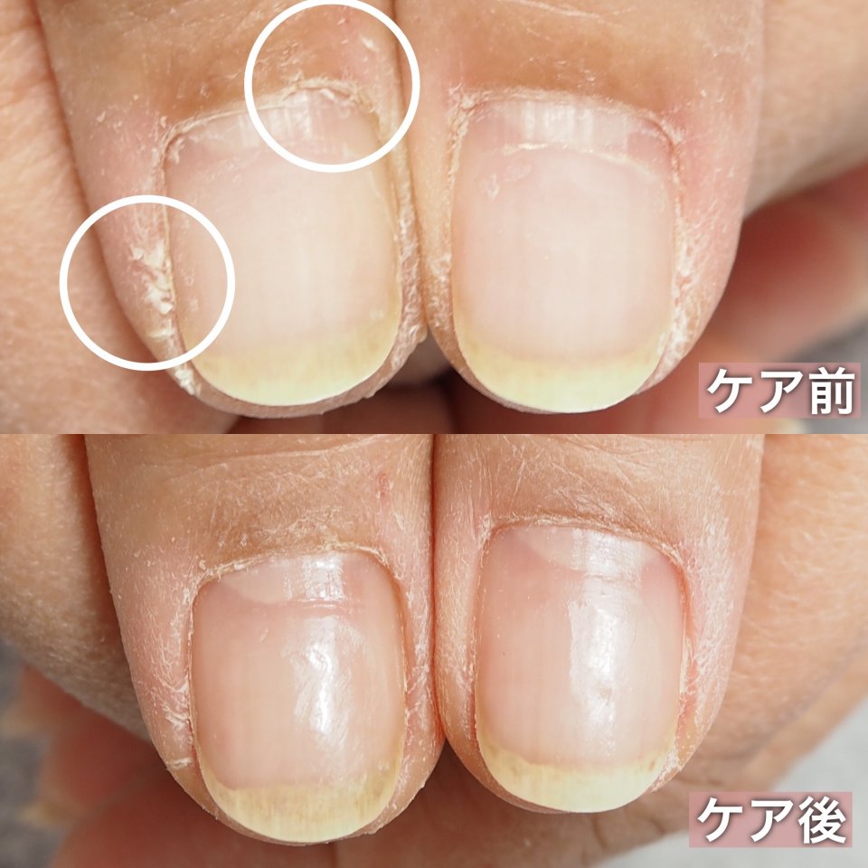 爪の甘皮処理のやり方を解説！セルフネイルのケアで行うときの手順は？ - Unknown Beauty