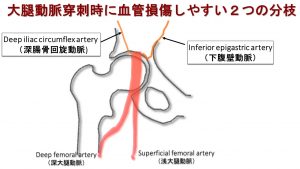 経鼻栄養チューブの挿入と管理（0:28:45） | カーディナルヘルス医療関係者向け製品情報サイト