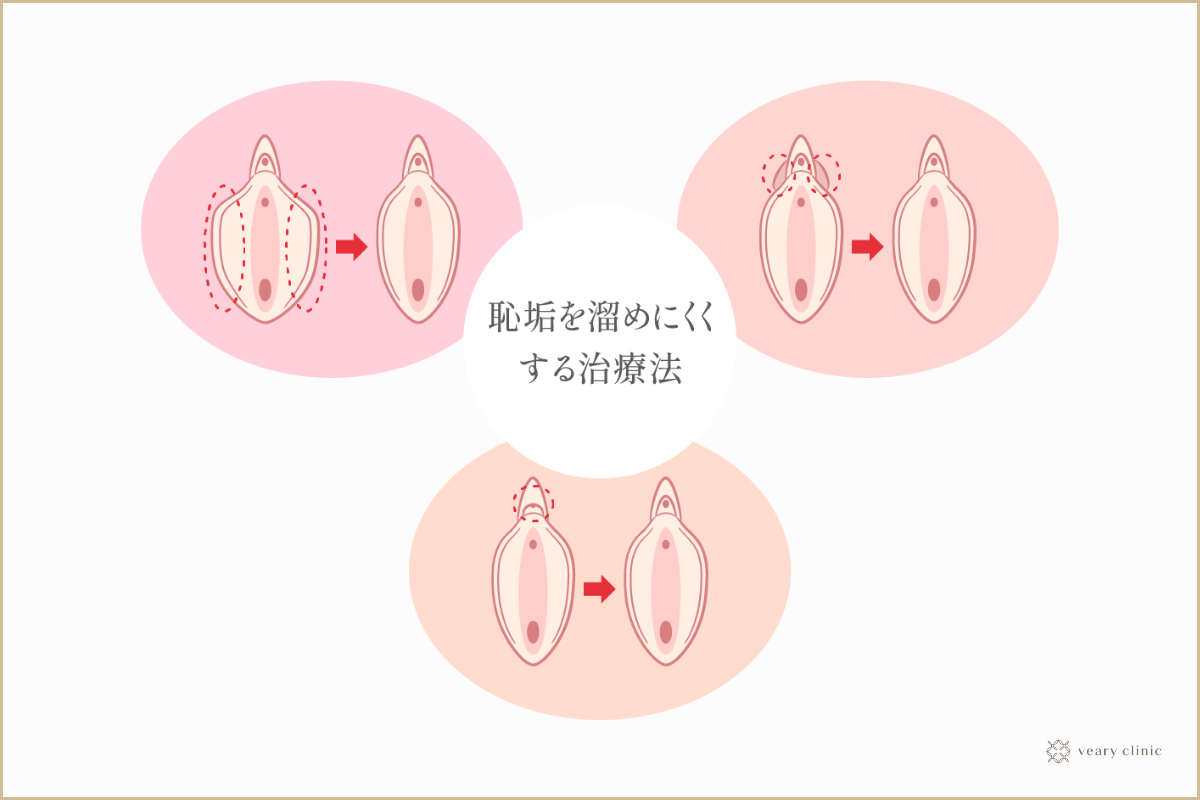 幸せな妻が欲しいですか?をしたいときにクリトリスを刺激する方法は次のとおりです