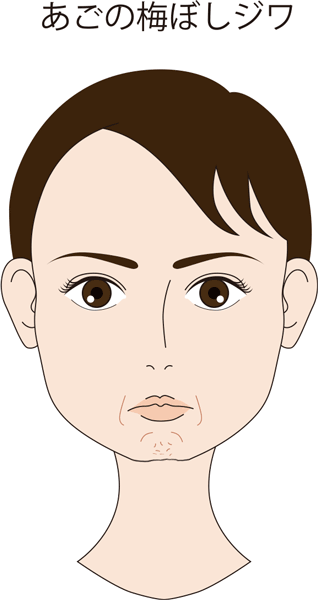 Youtube 更新！ 「 あごの梅干しシワ解消！」 骨格によって顎にシワが出やすい人もいますが、少しのケアで顎の梅干しジワは緩和できます♪※スタッフ投稿ですあごあごのシワ顎梅干しシワうめぼし筋肉たるみボトックスクリームスキンケア乳酸菌生成