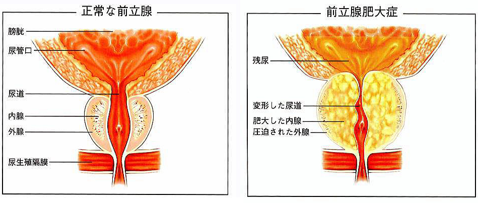 会陰オナニーとは？やり方や開発方法、射精への仕組みや道具について解説｜風じゃマガジン