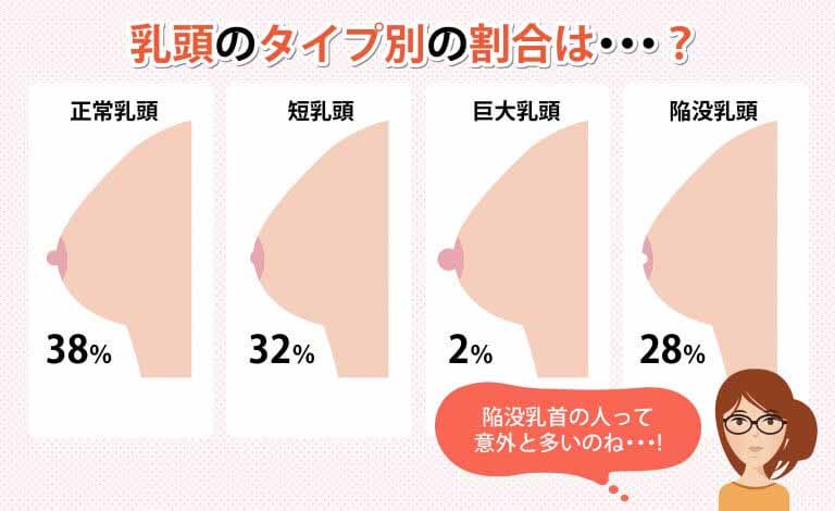 意外とみんな悩んでる… 乳輪・乳首をピンク色にする方法 |