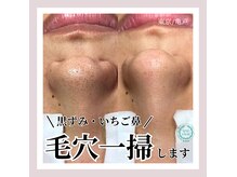 江戸川区でオススメ】メンズエステが得意なエステサロンの検索＆予約 | 楽天ビューティ