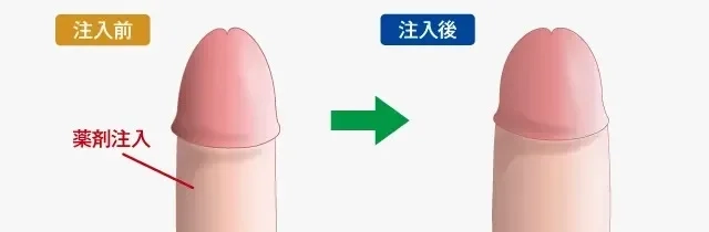 チンコの平均サイズ日本人はどのくらい？女性が喜ぶジャストサイズも公開！ | ペニス増大サプリおすすめランキング