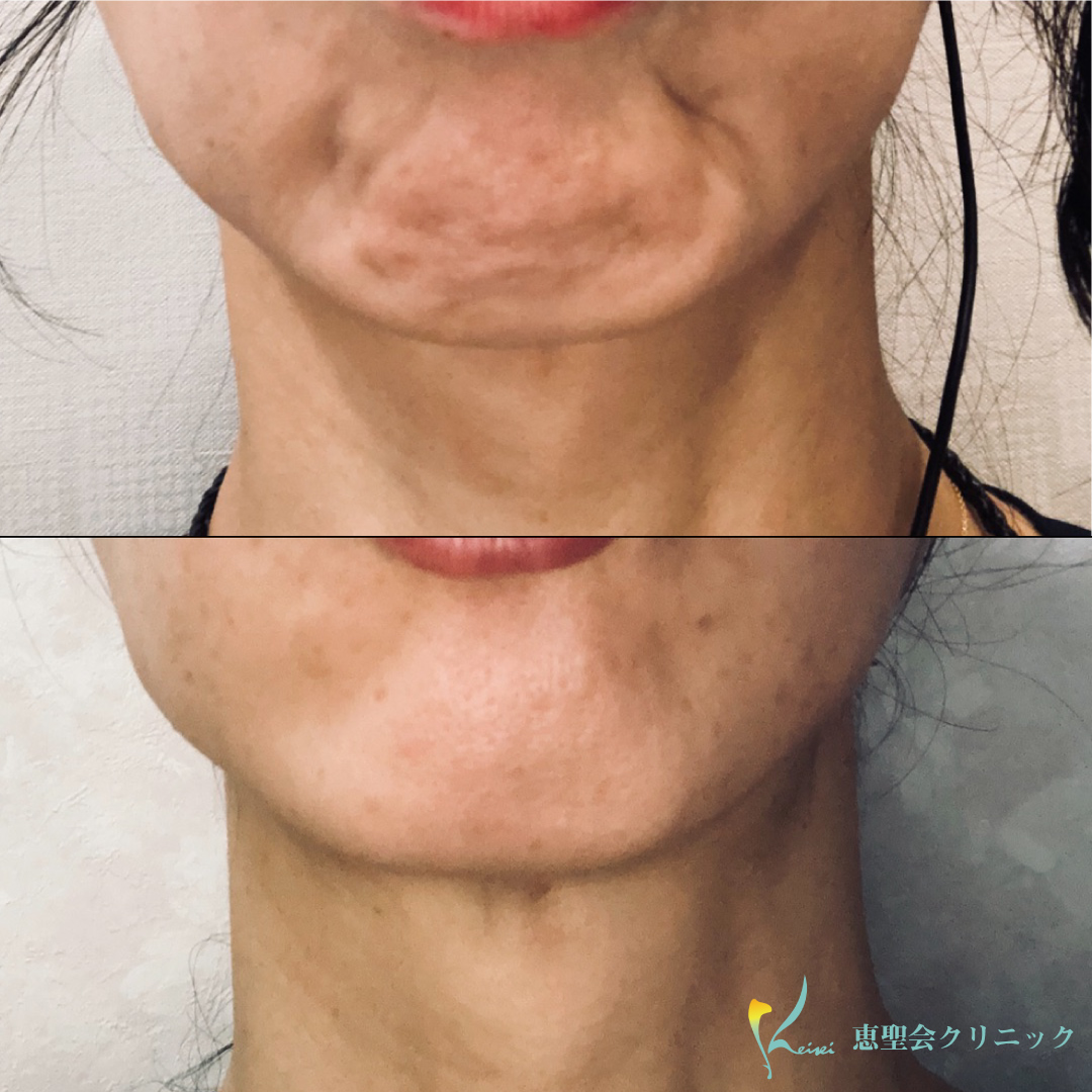 画像・写真元フジテレビ久代萌美アナ、吉本移籍で「男梅」の顔芸無茶ぶり 鬼越から「入って後悔してますね？ 笑 」 8枚目オリコンニュース ORICON NEWS