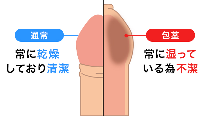 ちんこの皮が多い…」9割の男性が知らない皮が多いデメリットとは？ | 【フェアクリニック】包茎・薄毛・男の悩み相談所