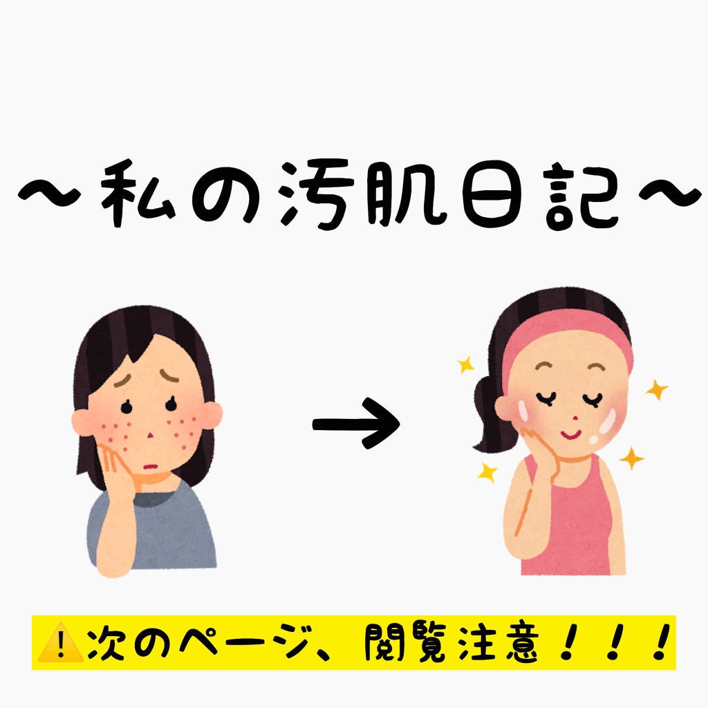 育児まんが日記「せかいはことば」 | せかいはことば