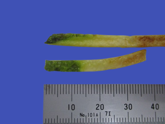 先端が緑色のポテトは本当に食べても大丈夫
