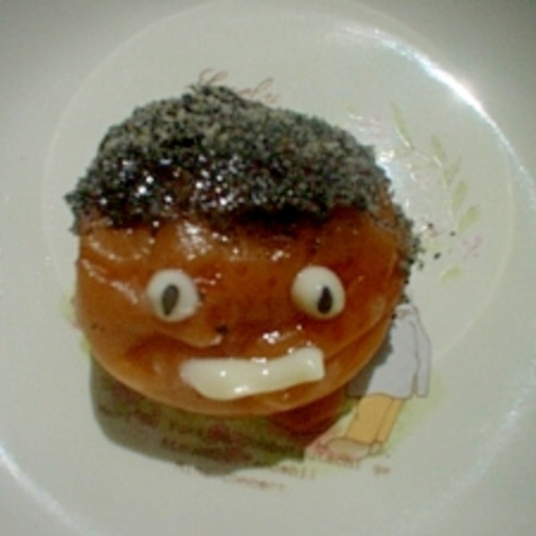 梅干しジワと顎のヒアルロン酸の関係大阪・難波で美容整形外科・美容皮膚科ならMIYAフェイスクリニック