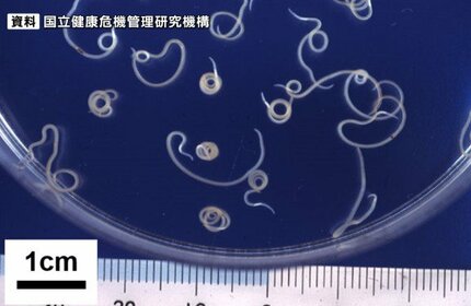 アニサキス報道は間違いだらけ 正しくアニサキスを知る重要なポイントまとめ