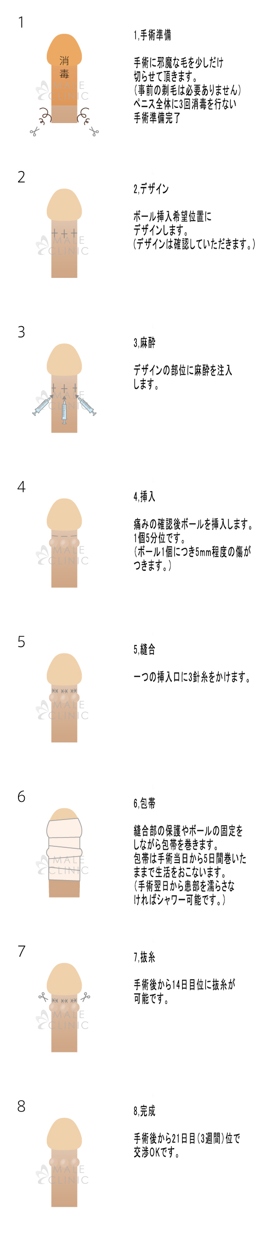 俺は卒業式でちんこを出そうとしている | オモコロ