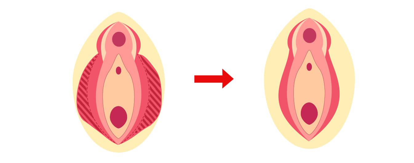 クリトリスの皮を剥くコツは？クリイキするための正しい剥き方をイラストでチェック