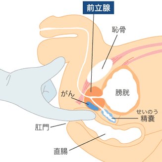 アナルオナニーをするなら前立腺・膀胱・精嚢の位置をイメージせよ | アネドラ