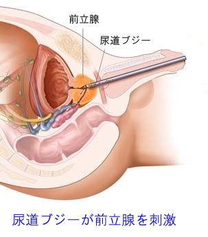 男の尿道を刺激するタイプのオナニーグッズ | Hな体験談を友人に聴いた。日々の生活に刺激を求めて～