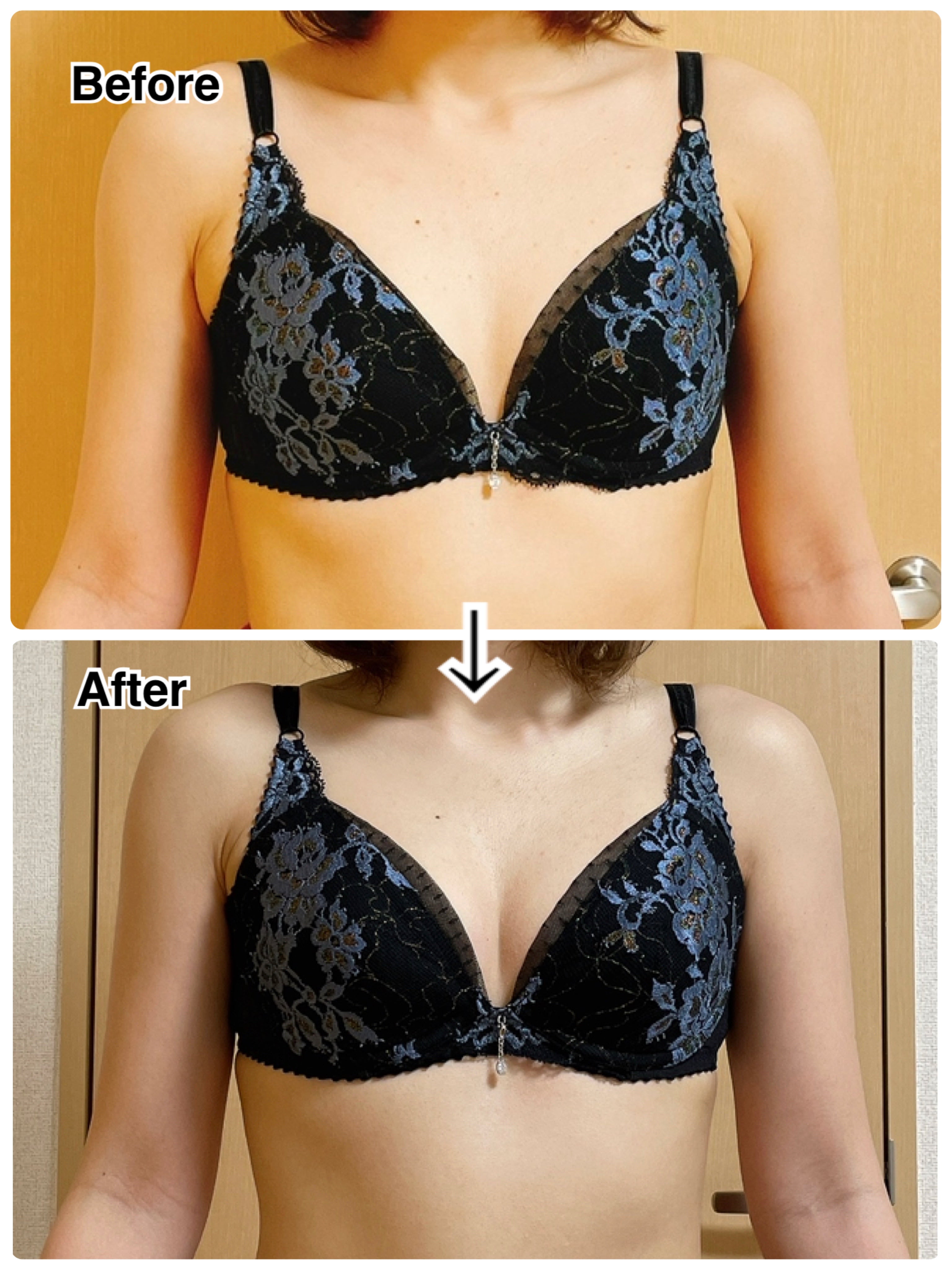 乳房の形 種類 おわん型のイラスト素材115930552- PIXTA