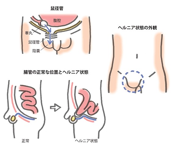 奈良県の鼠径ヘルニア(そけいヘルニア)/脱腸の専門治療が可能な病院 24件 【病院なび】