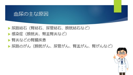 結石はどうしてできるの？｜オムロン ヘルスケア