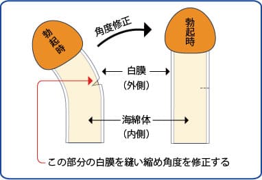 しンさく…♡ 反りチン | 躁鬱漫画集