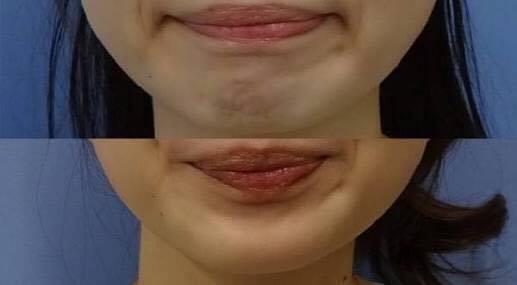 みんなの投稿～梅干しの石神邑から～すっぱい顔大募集！梅干しお試しセットモニター募集紀州 石神邑