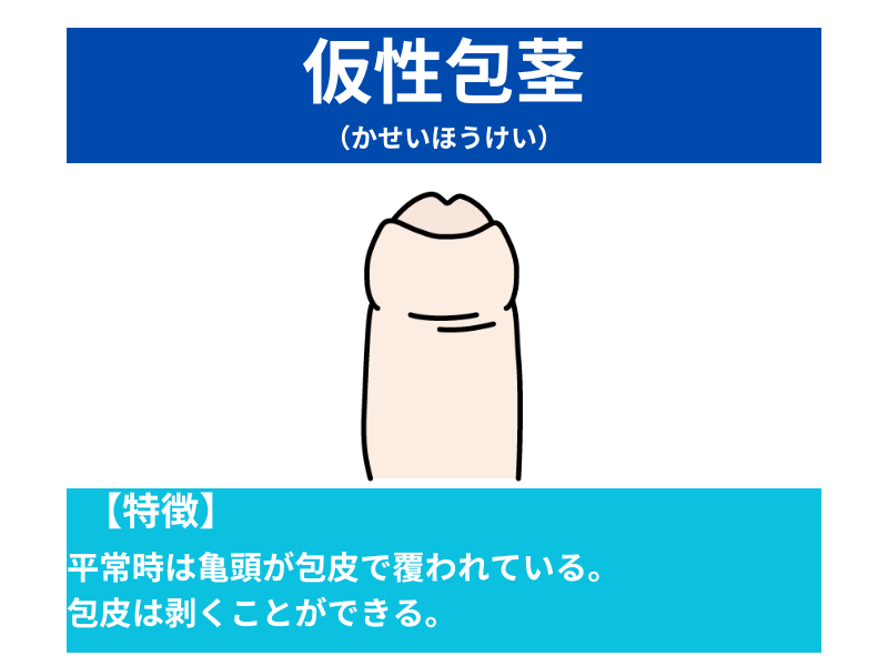 子どもの包茎」むきむき体操（包皮翻転指導）のすすめ – いしゃまち