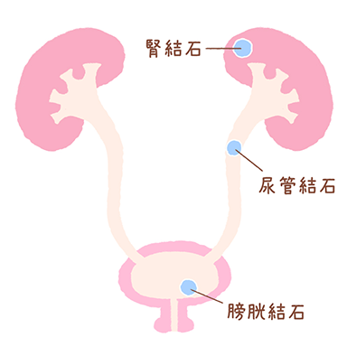 県立広島病院／泌尿器科