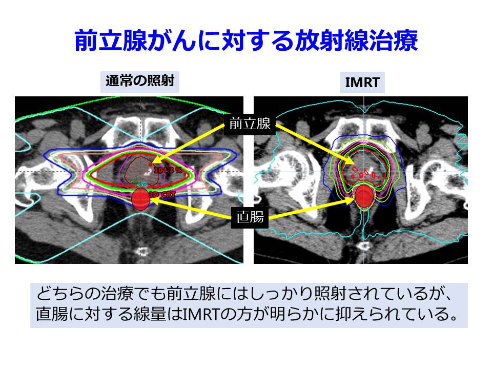 泌尿器科｜渋谷駅前メディカルクリニック｜尿路感染症