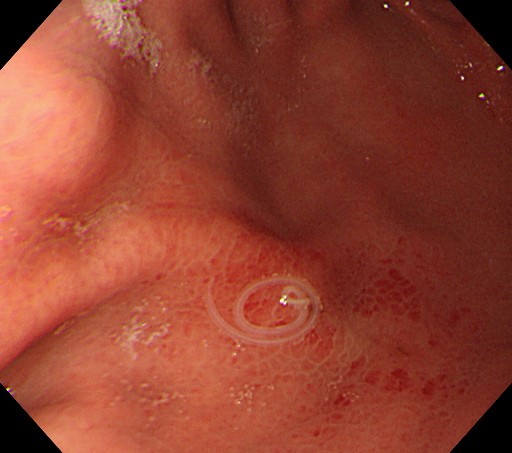 スズキの刺身、しゃぶしゃぶ、三枚おろし 、白子、魚卵の煮付け、つくり方動画 - 魚料理と簡単レシピ