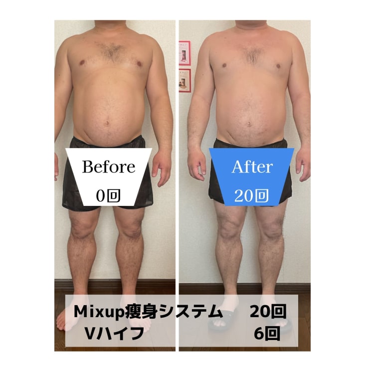 ダイエットが続かない男性必見！痩身エステの魅力とは？！施術内容などを詳しく解説◎｜男性美容ポータルサイトMen's Labo~メンズラボ~