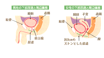 性行為（セックス）は尿路結石症の改善に役立つ可能性がある【医師監修】 | 新橋ファーストクリニック【公式】