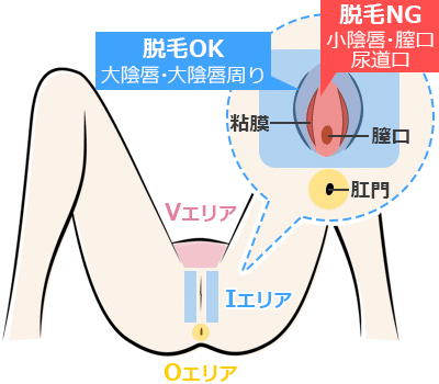 風俗嬢はパイパンにした方がいい？ 男性にリアルな本音聞いてみた |