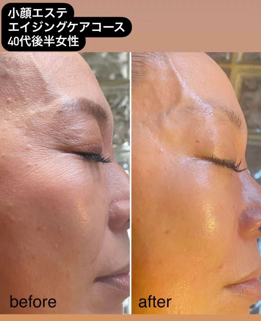 ネット予約可】脱毛・フェイシャル Beauty Salon LINOAH 心斎橋店