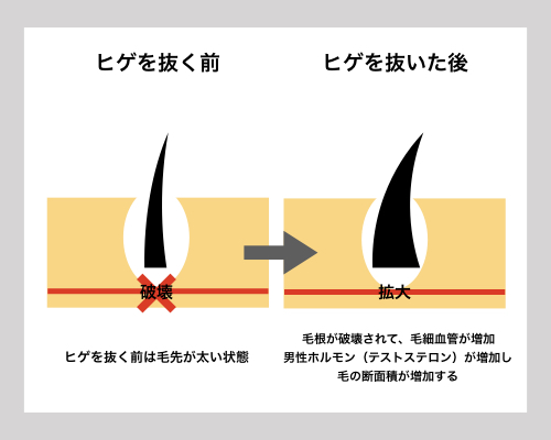 毛は剃ったら濃くなる？ 人体にまつわる3つの迷信 -