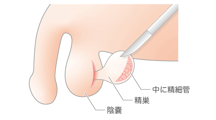 腟外射精の避妊率は？ - 市川市の産婦人科「佐野産婦人科」