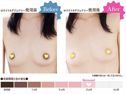 乳首をピンクにする方法のQ&A一覧｜美容・化粧品情報はアットコスメ