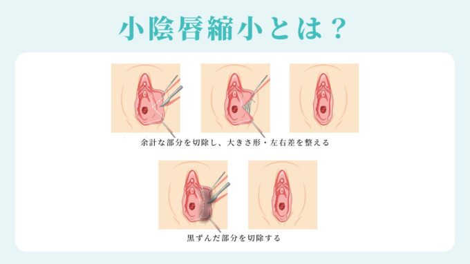 顔出し マンコが2個つ！？世にも稀な剛毛陰部。保育士さんの裏側に迫る - 無料エロ動画付き（サンプル動画） -